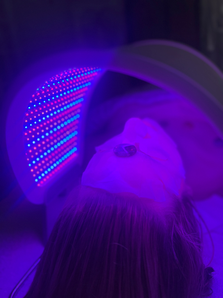 LED Healite &  Vit Treatment