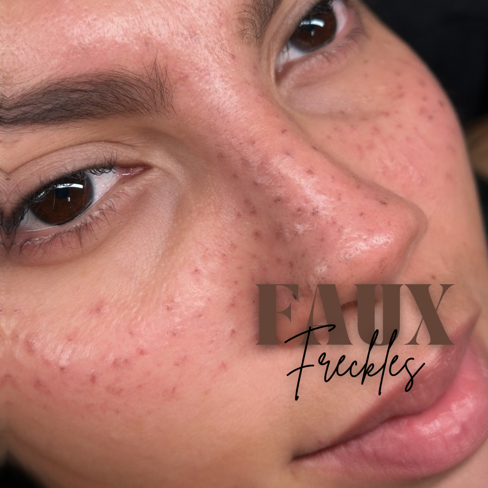 Feaux Freckles ✨ New service ✨