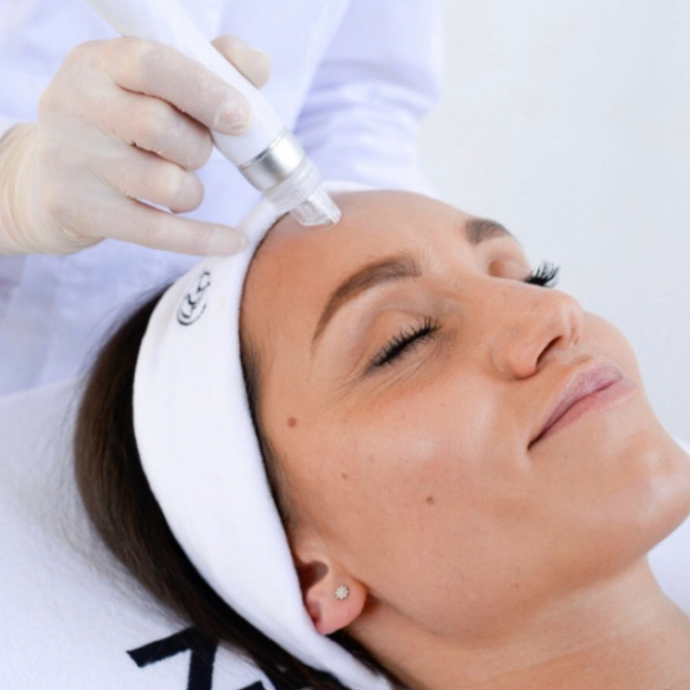 HydroFacial Glow at Del Sol Skin in East Islip, NY