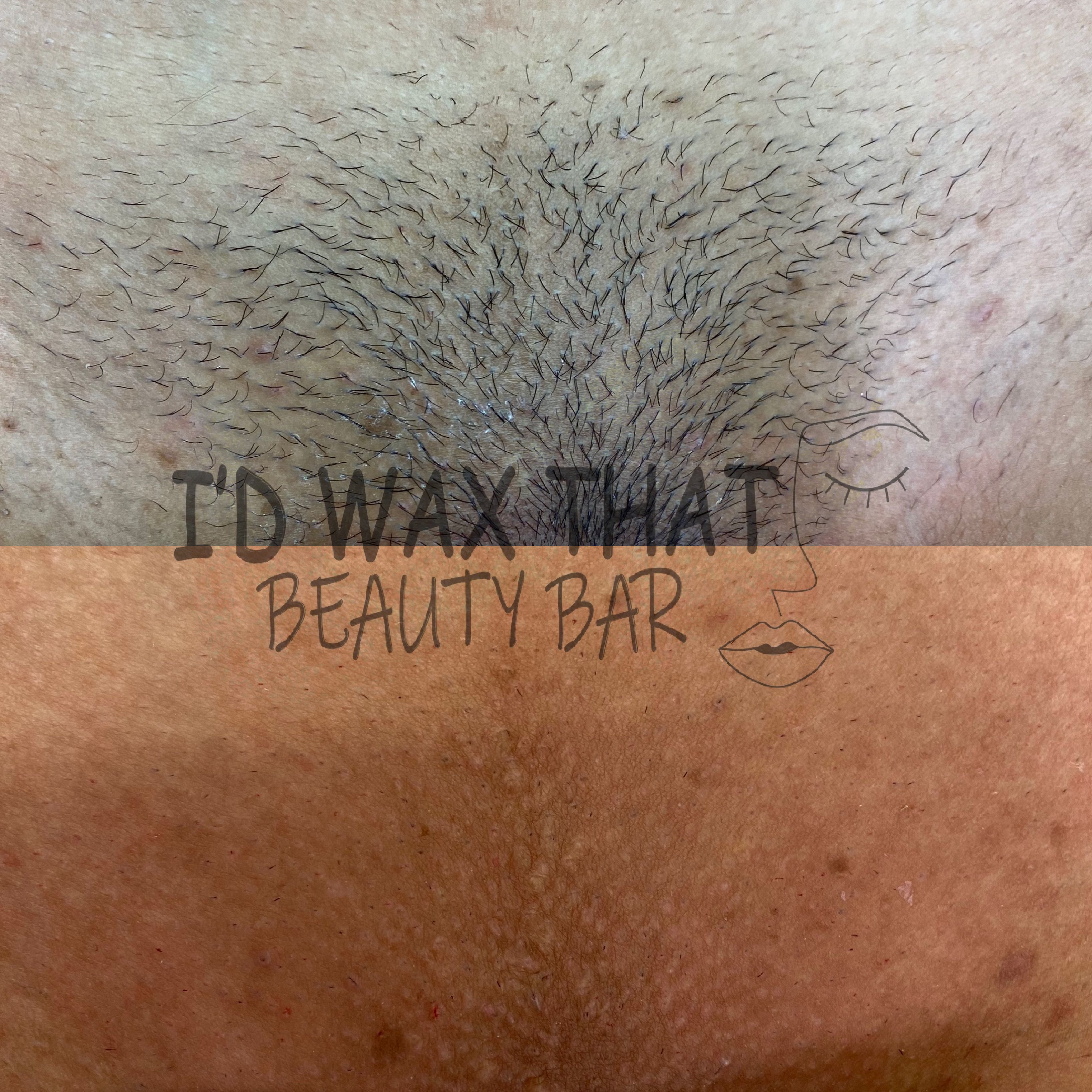 New Client Bikini Full