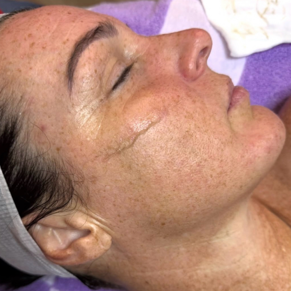 The Baby Face (Jamie) at Graceful Effects Day Spa in Brandon, MS