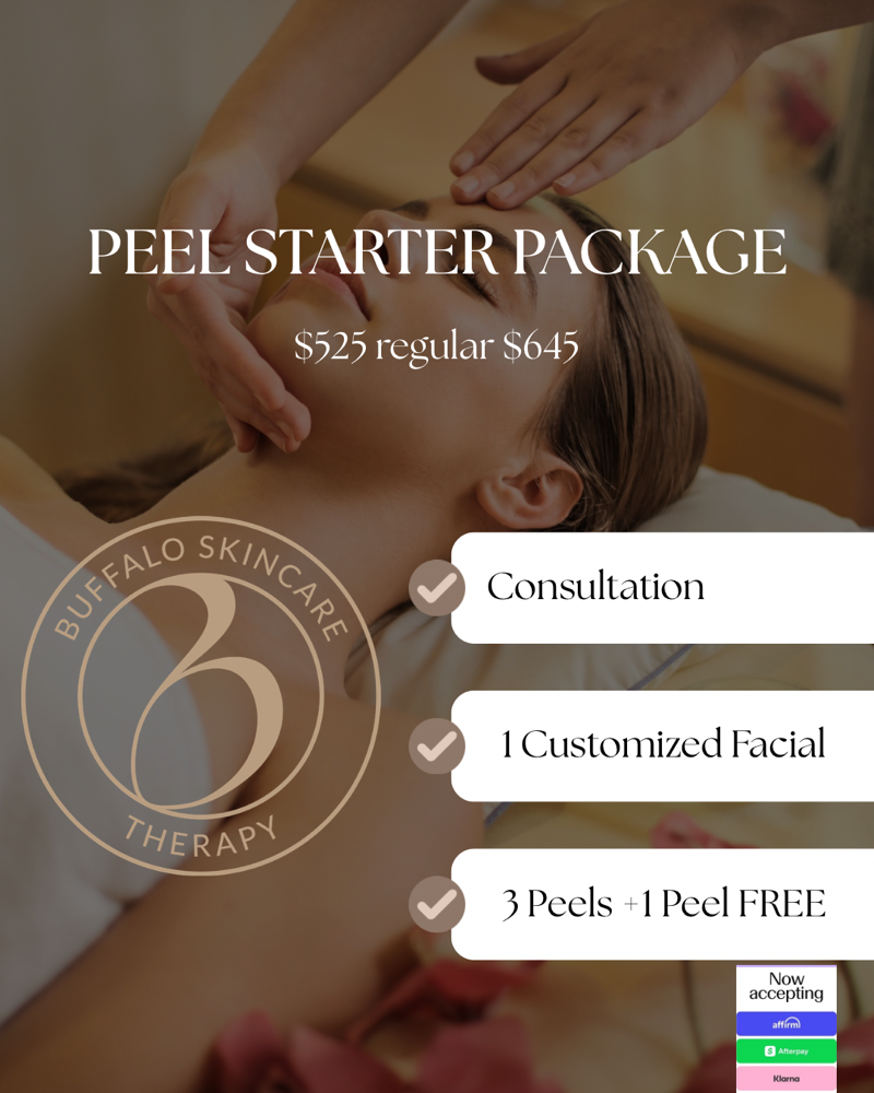 Peel Starter Pack (Limited Time)