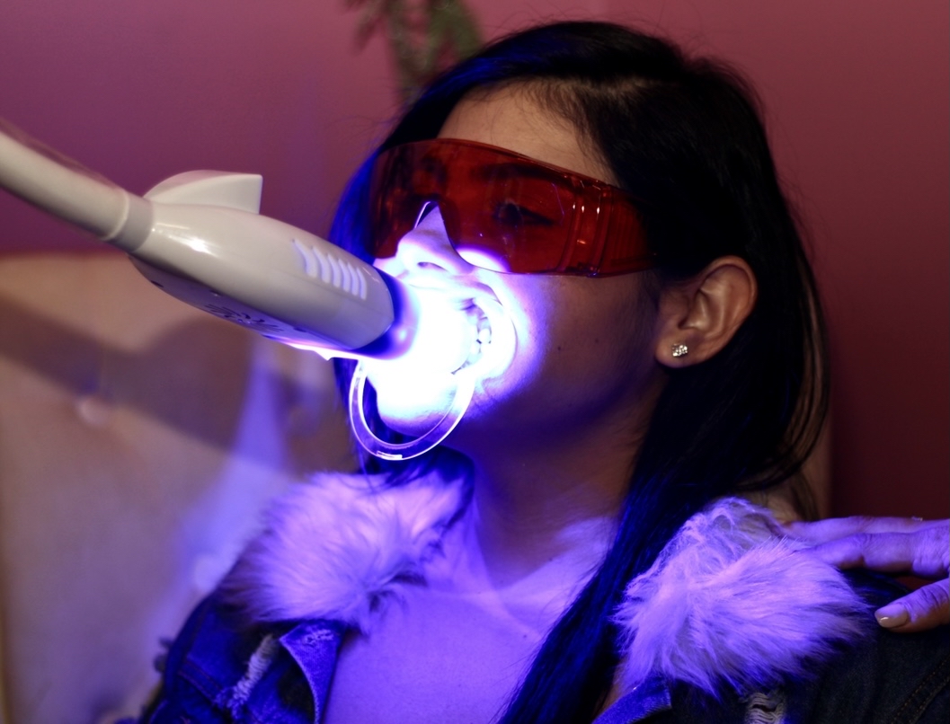 Teeth Whitening