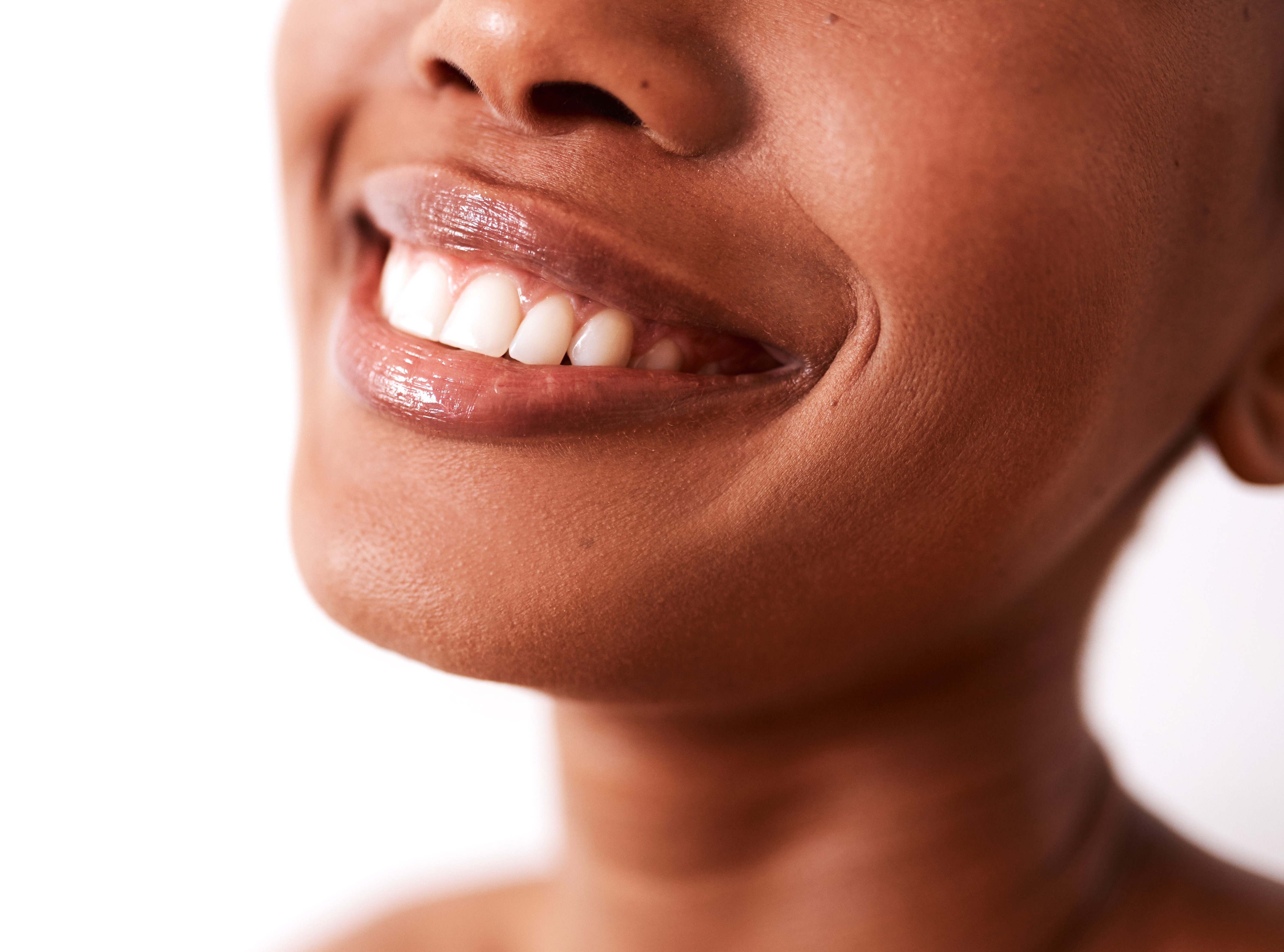 1 Double Chin Reduction