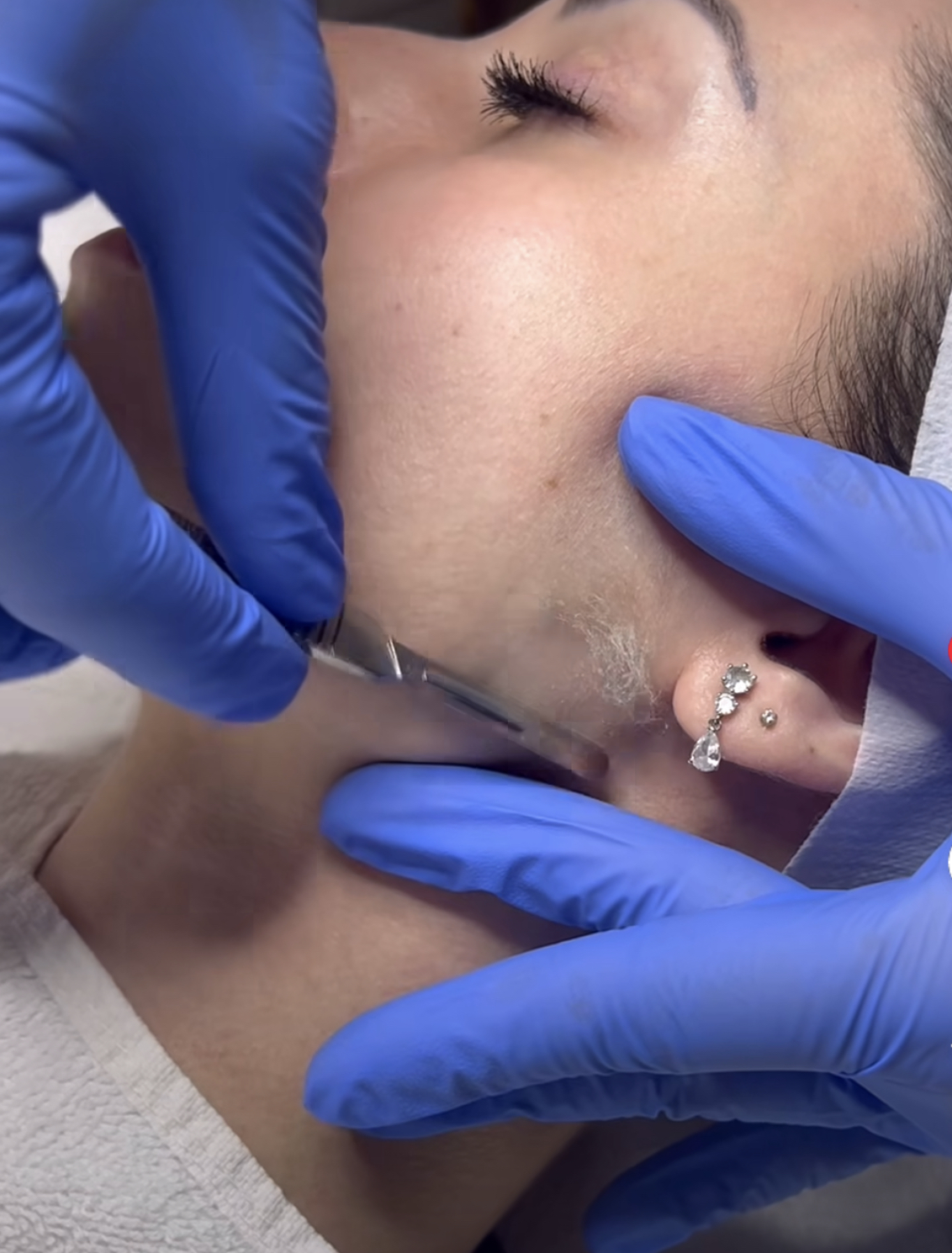 Dermaplaning Facial