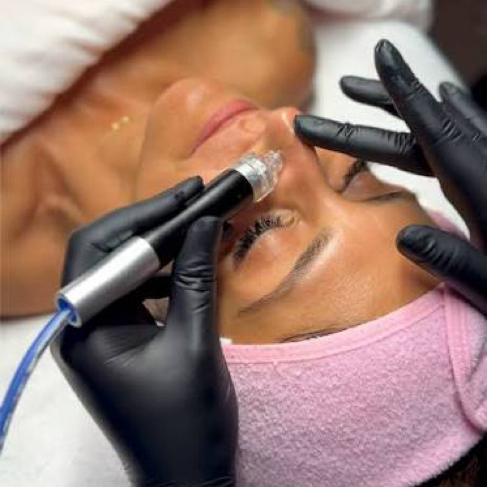 Skin Pro Hydro Facial (60 Min) at Skin Pro KC in Kansas City, MO