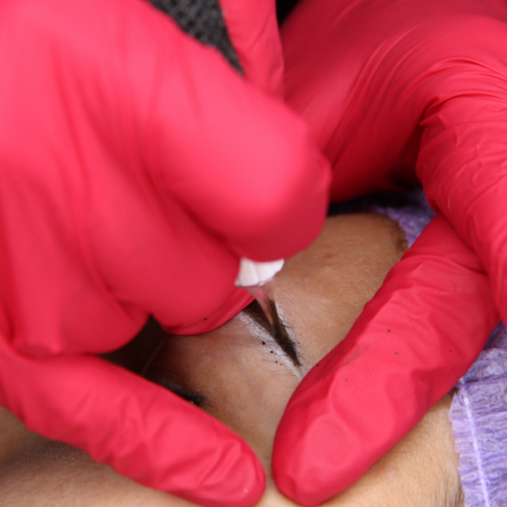 REFRESH (3–18 months)