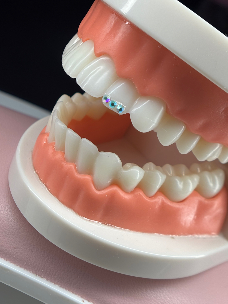 Tooth Gem Model