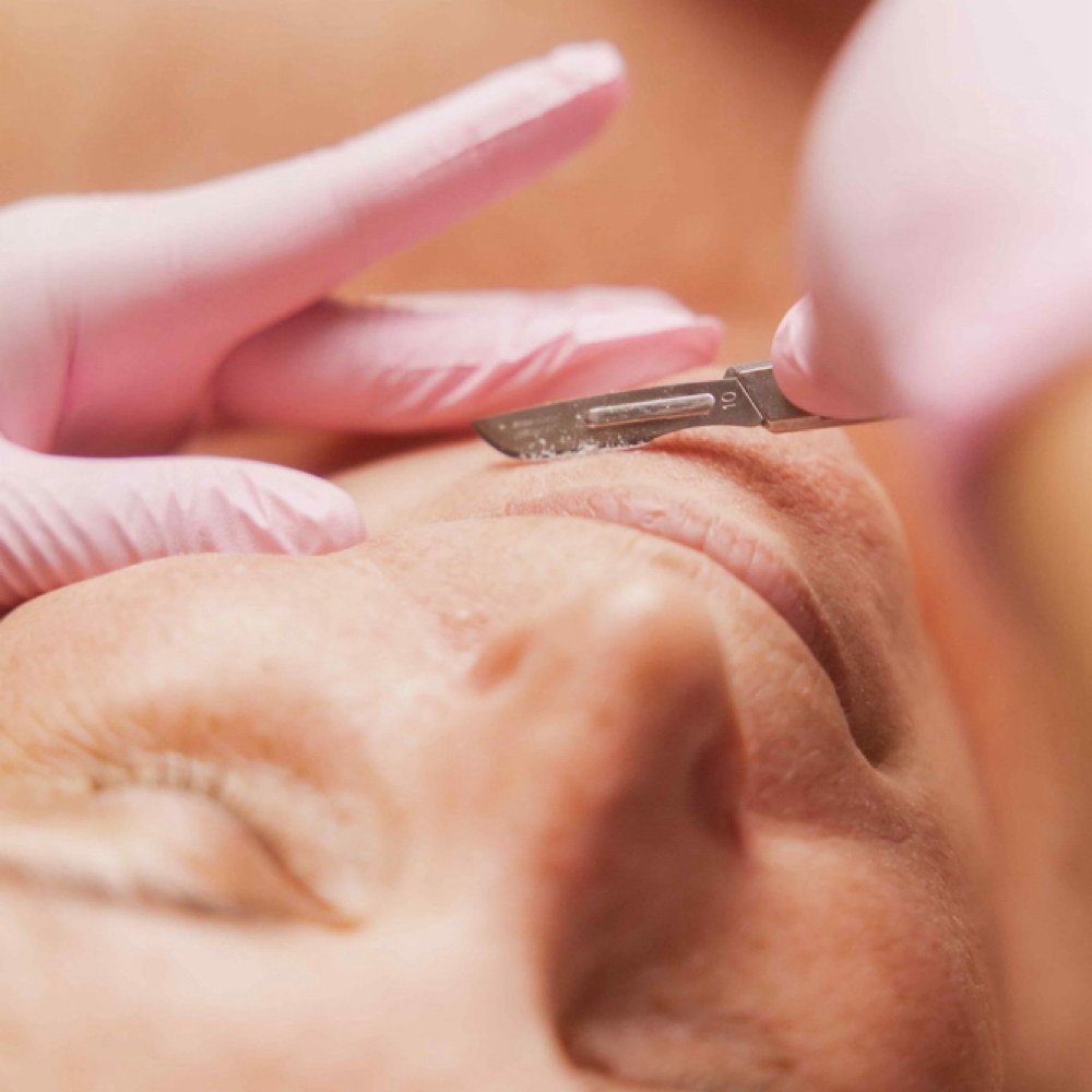 Customized Facial + Dermaplaning at A&A Beauty Bliss in Cape Coral, FL
