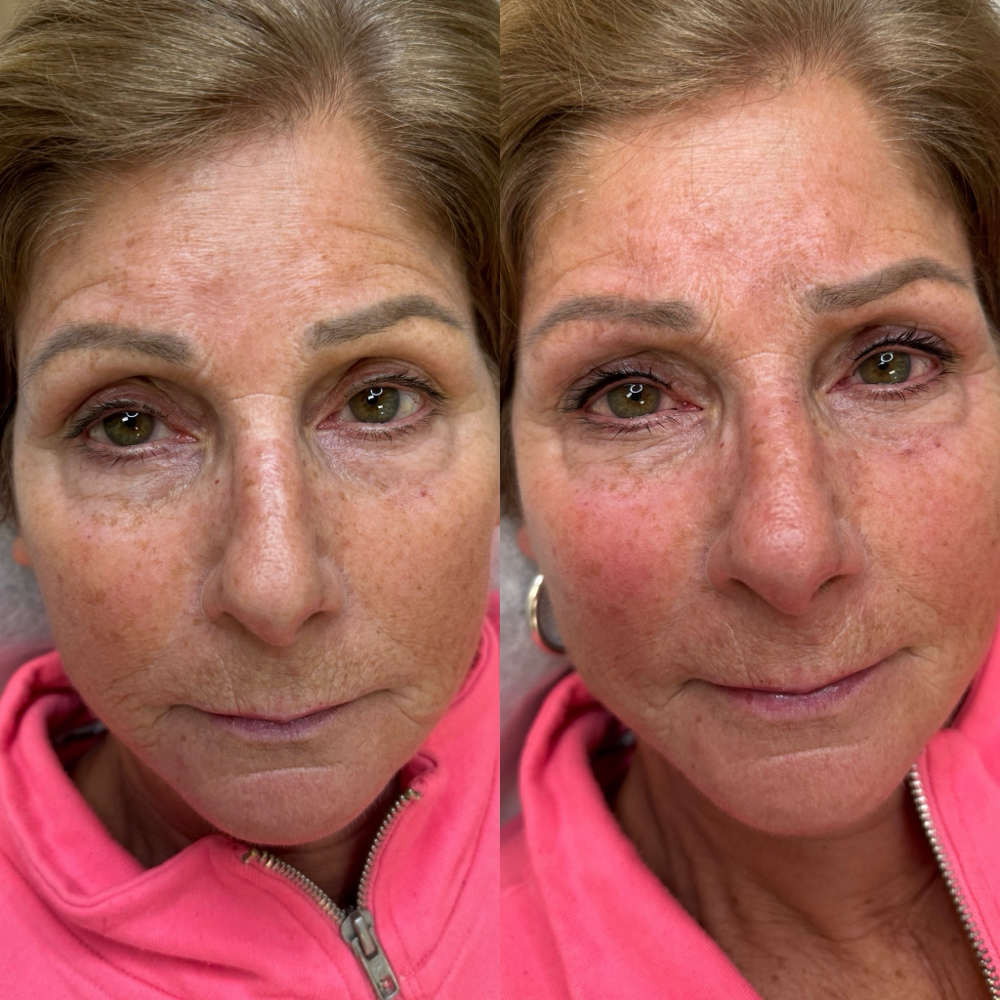 Permanent Eyeliner (top Only) at Highbrow Beauty, Inc. in Framingham, MA