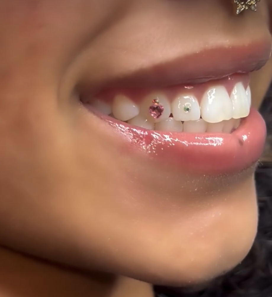 3 Gems at Luxe Glow Smiles in orlando, FL