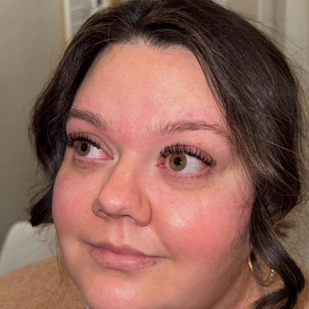 Hybrid Mini Fill at Esthetics with Ali in Burleson, TX