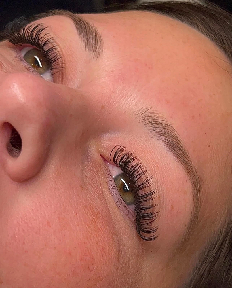 Hybrid Mini Fill at Esthetics with Ali in Burleson, TX