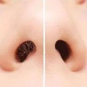 Nose Waxing at EURO WAX & SPA in Hayesville, NC