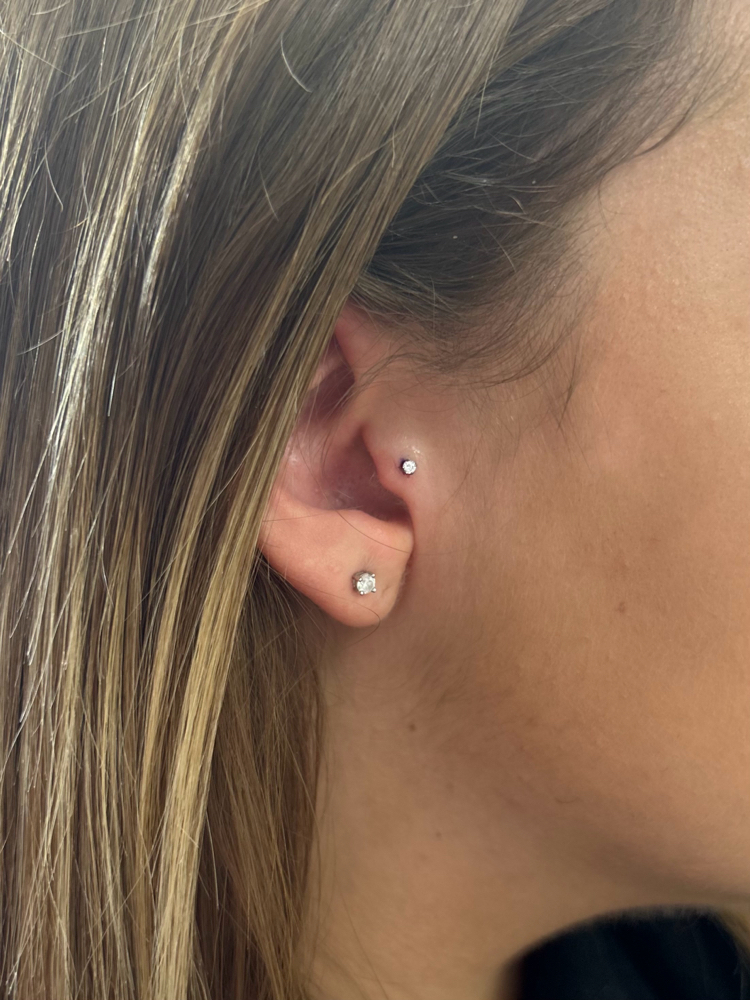 Tragus