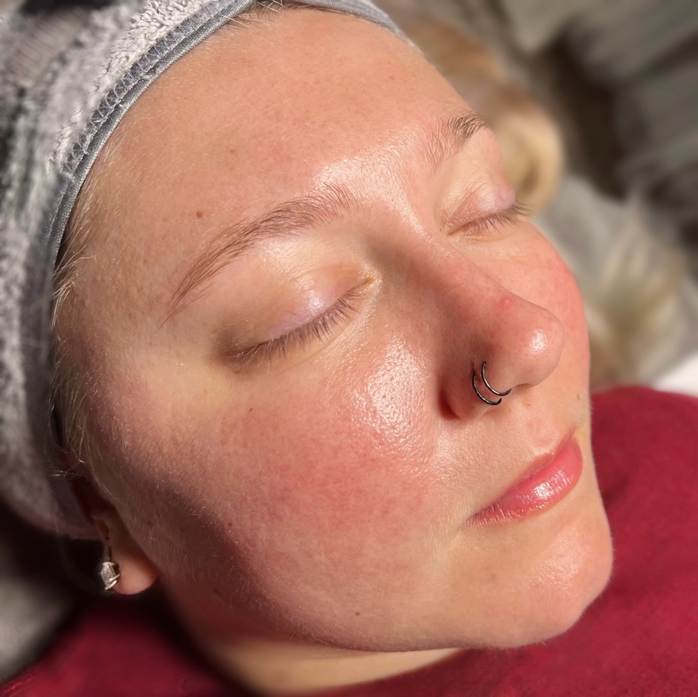 Summer Skin Facial