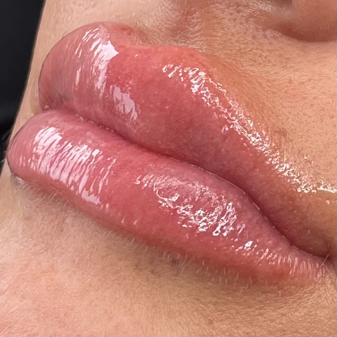 Lip blush/neutralization