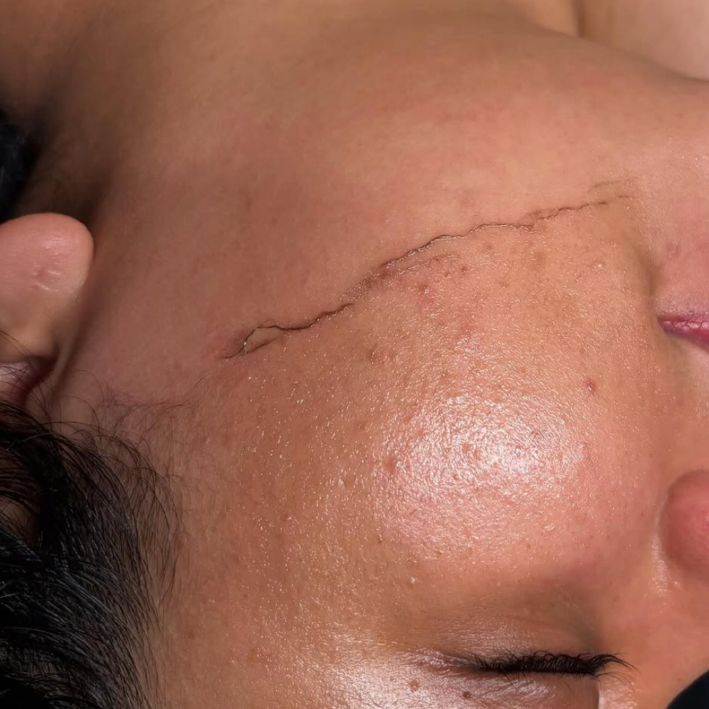 Mini Dermaplane at Bre’s Blended Beauty LLC in Fort Worth, TX