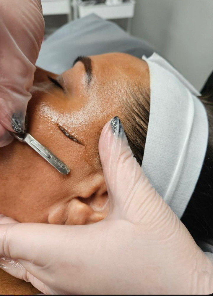 Dermaplaning Facial