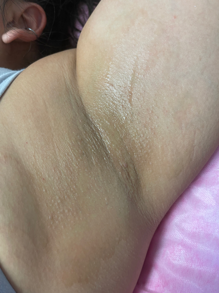 Underarms Wax