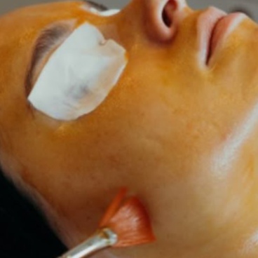 Chemcial Peel at Ava Beauty Bar in Lehi, UT