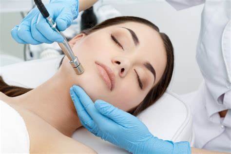 Diamond Microdermabrasion