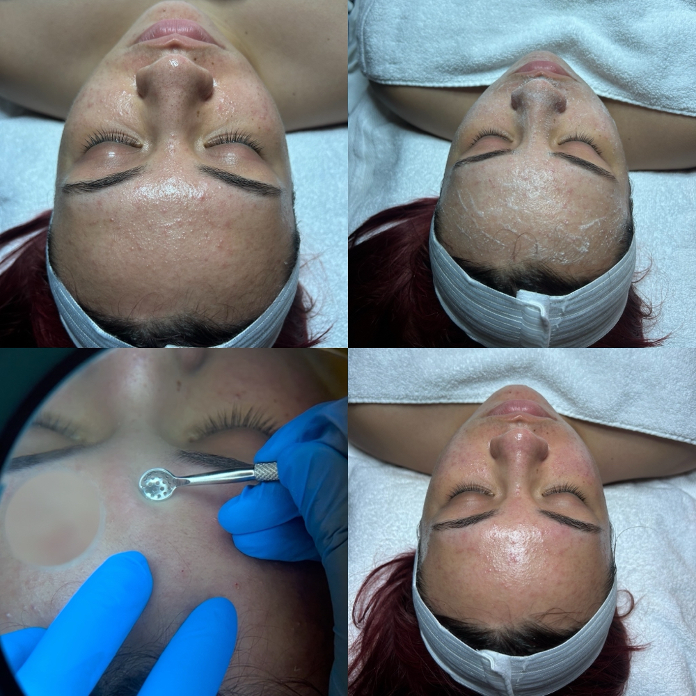 Essential Glow Facial at Drea’s Beauty Shop in Oxnard, CA