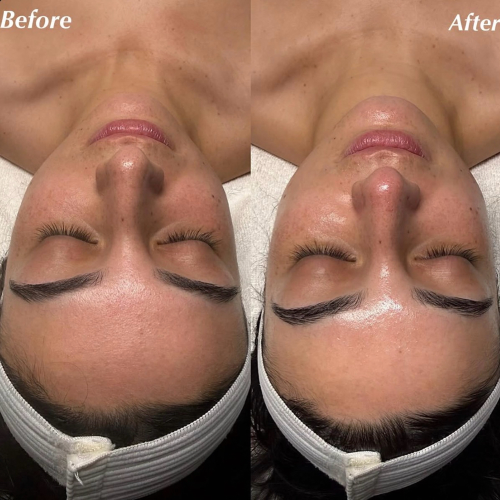 1. Essential Glow Facial at Drea’s Beauty Shop in Oxnard, CA