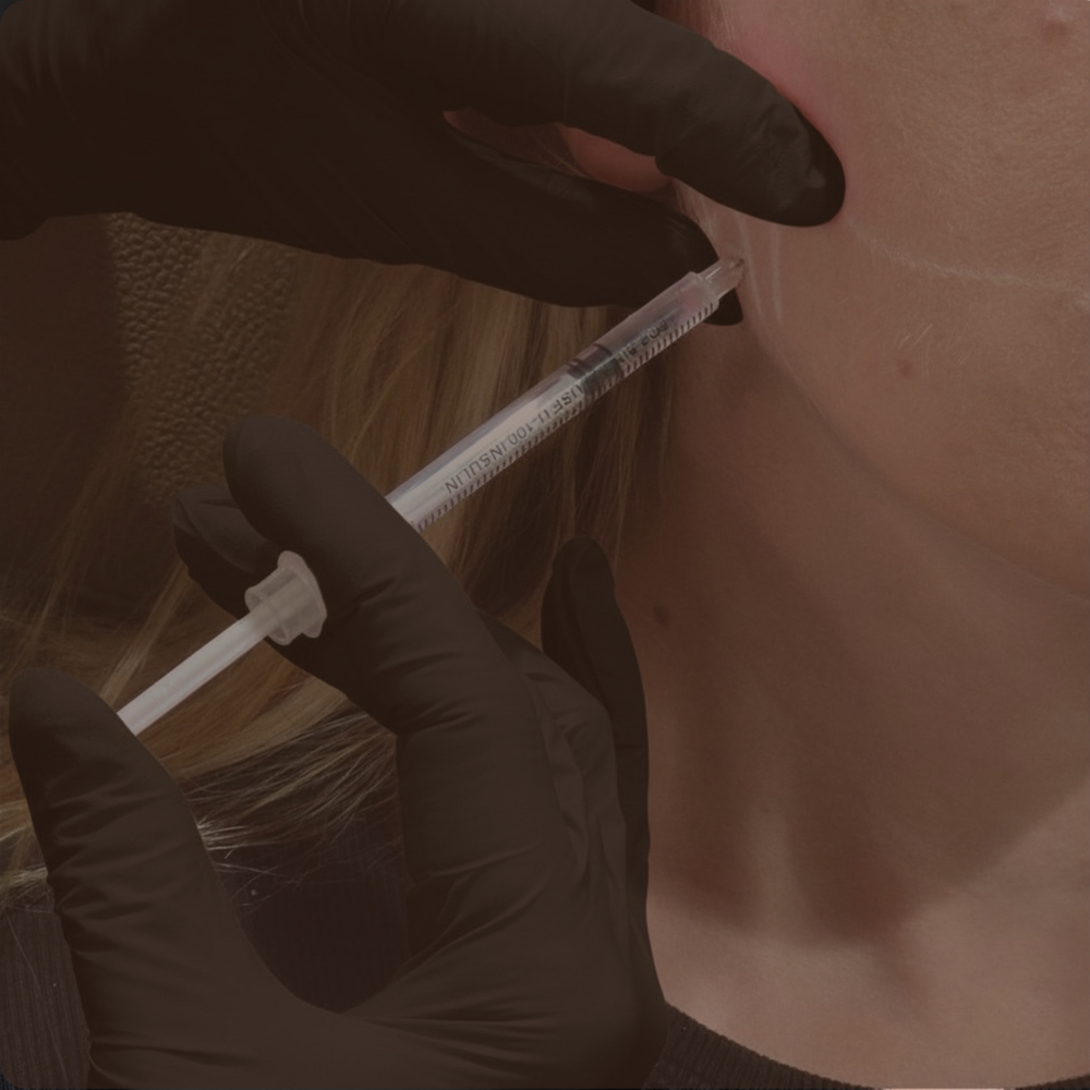 Masseter Botox (Facial Slimming) at SKN on Main in Dennis, MA