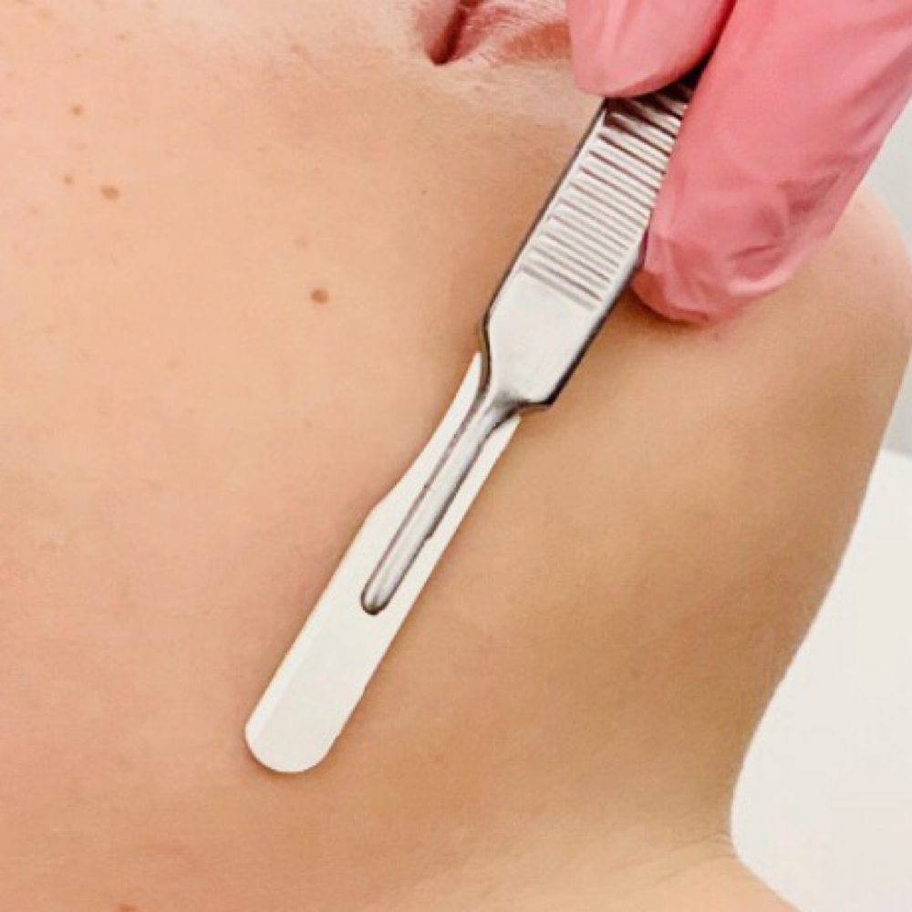 ADD-ON DERMAPLANING TO ANY FACIAL at Amy Shafer Aesthetics in Nashville, TN