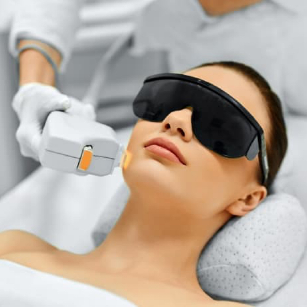 IPL X-Small Single Treatment