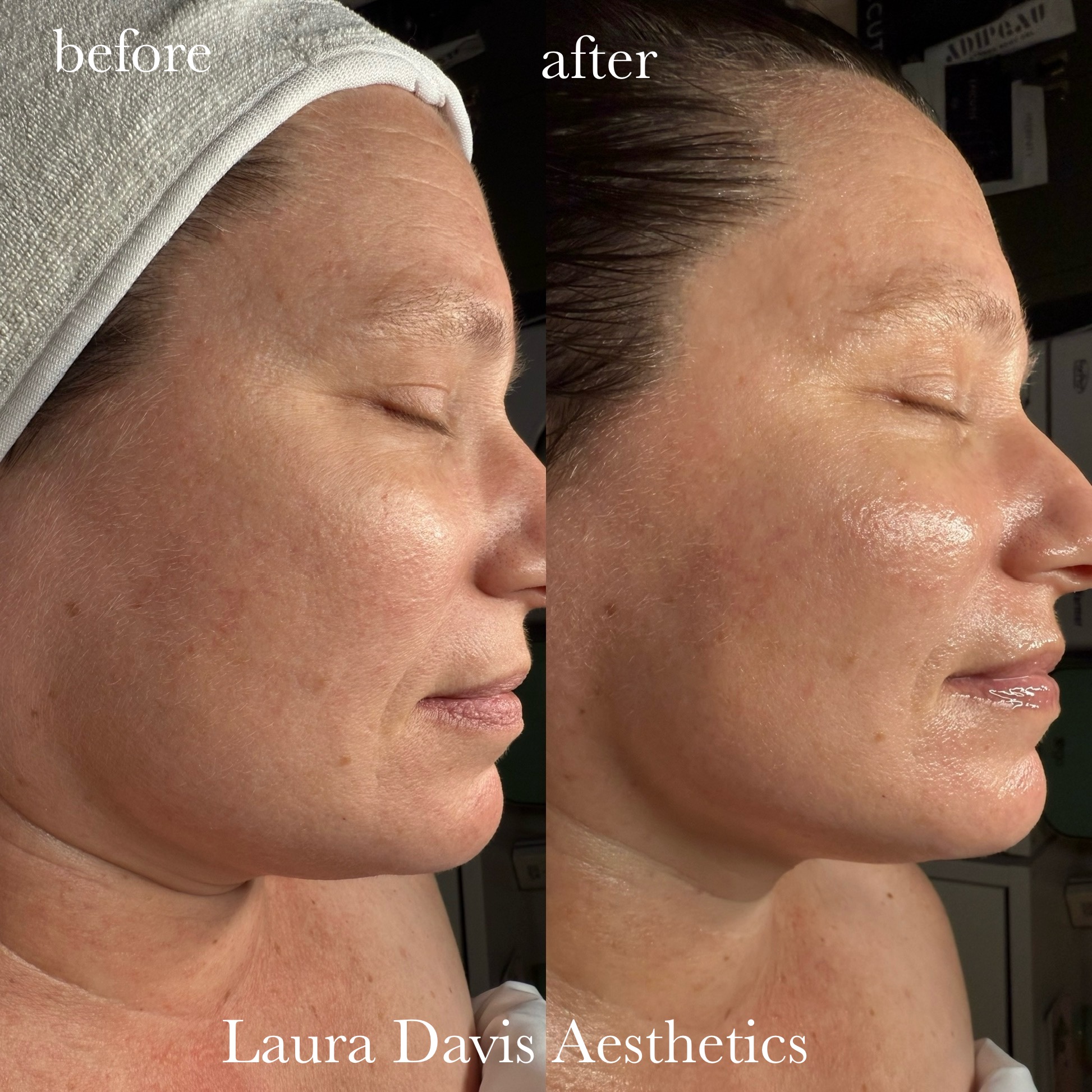 O2 Sculpt + Glow Ritual