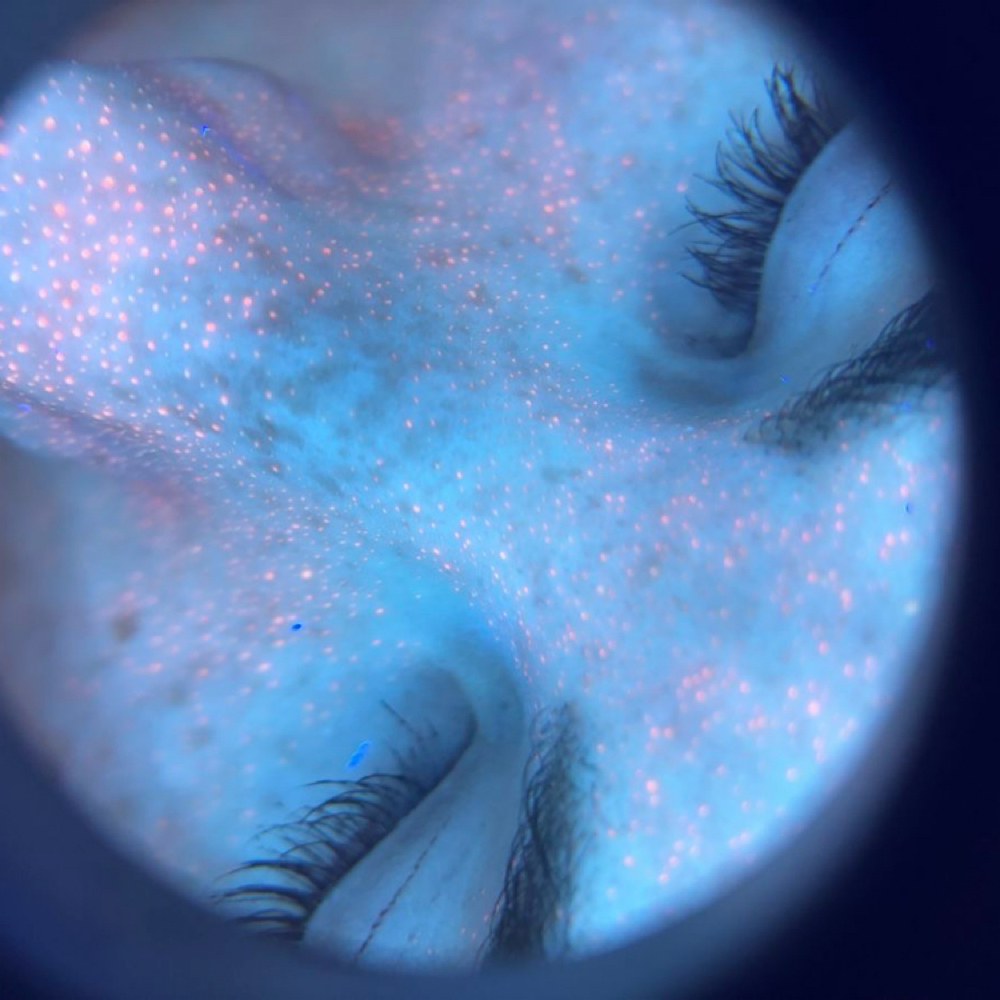 Skin Analysis at Leisure Esthetics Studio LLC in Anderson, IN