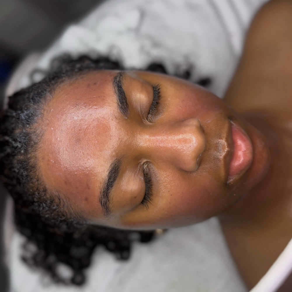 Crystal Quartz Renewal Peel at Skin Pretty Med Esthetics in Private Suite, MO