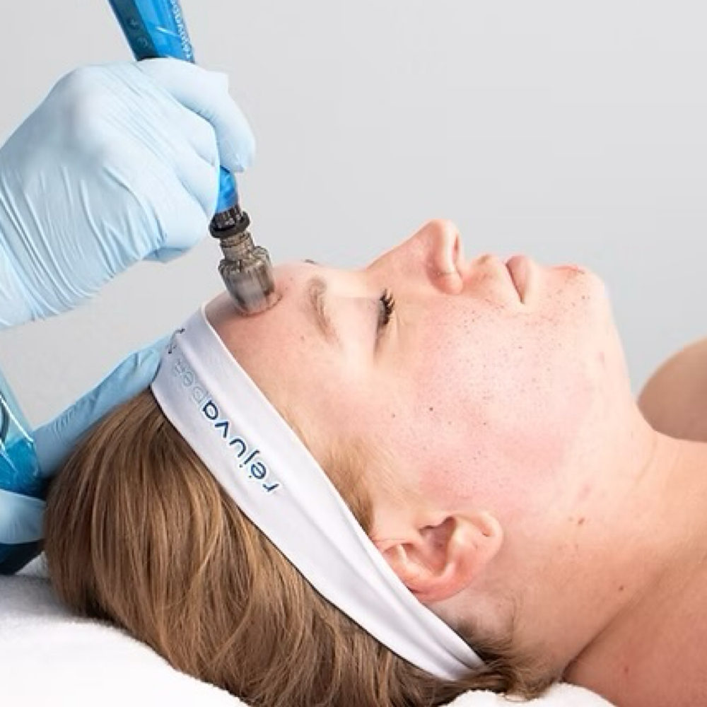 Microneedling + Growth Factor (Face at APMU MED SPA | Atlanta Aesthetics & Permanent Makeup in Marietta, GA