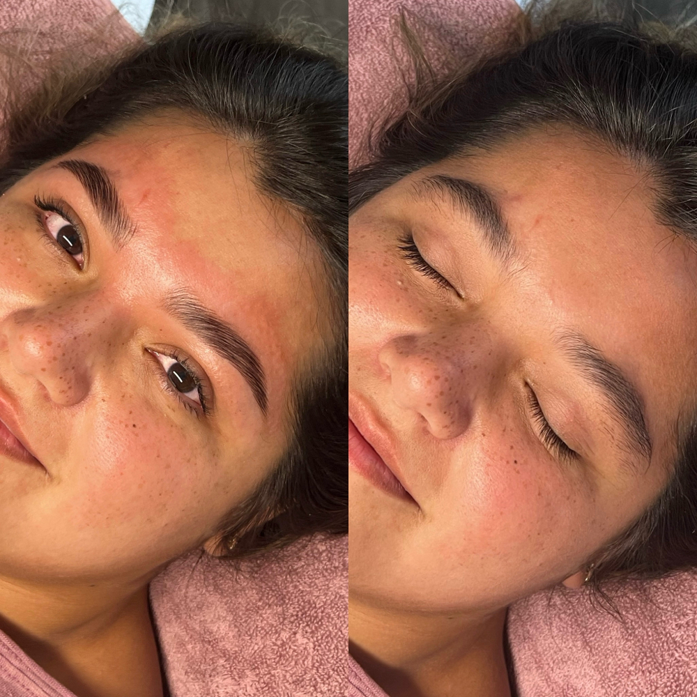 Brow Lamination