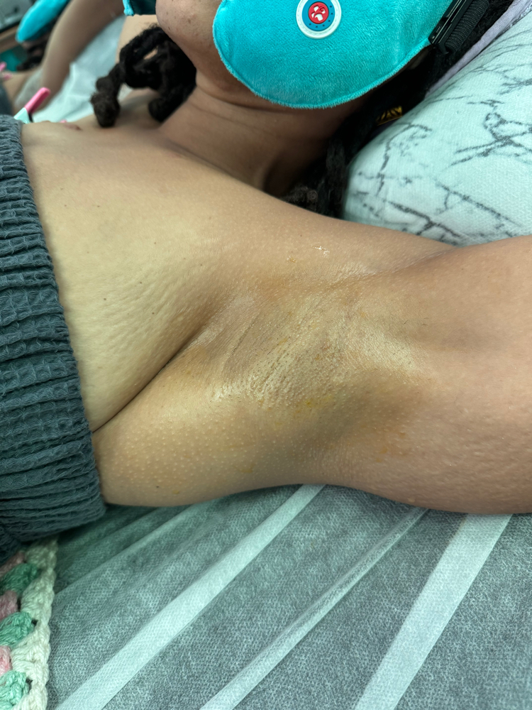 Underarm & Castro Oil Pull 📍Vegas