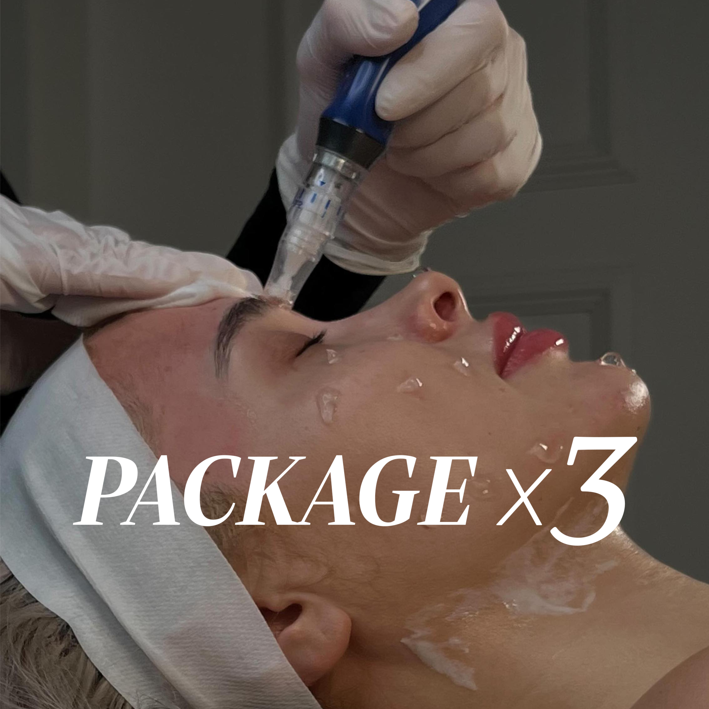 Package X 3 | MICRONEEDLING
