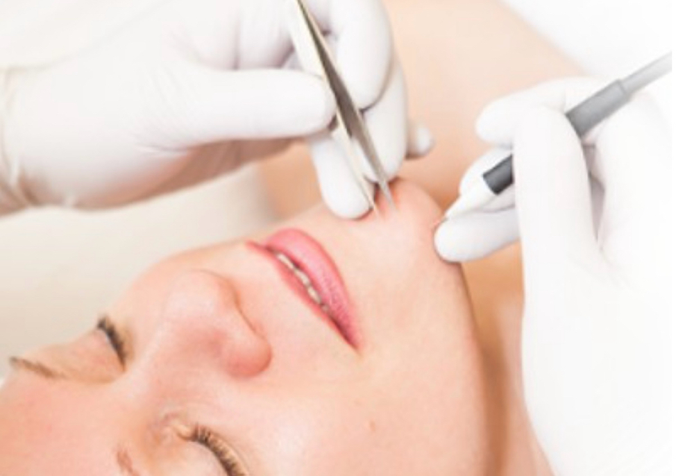 Electrolysis 30 Minute Session