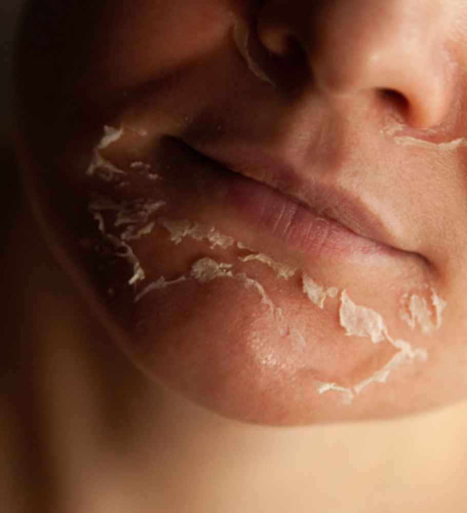 Advanced Skin Renewal Treatment *
