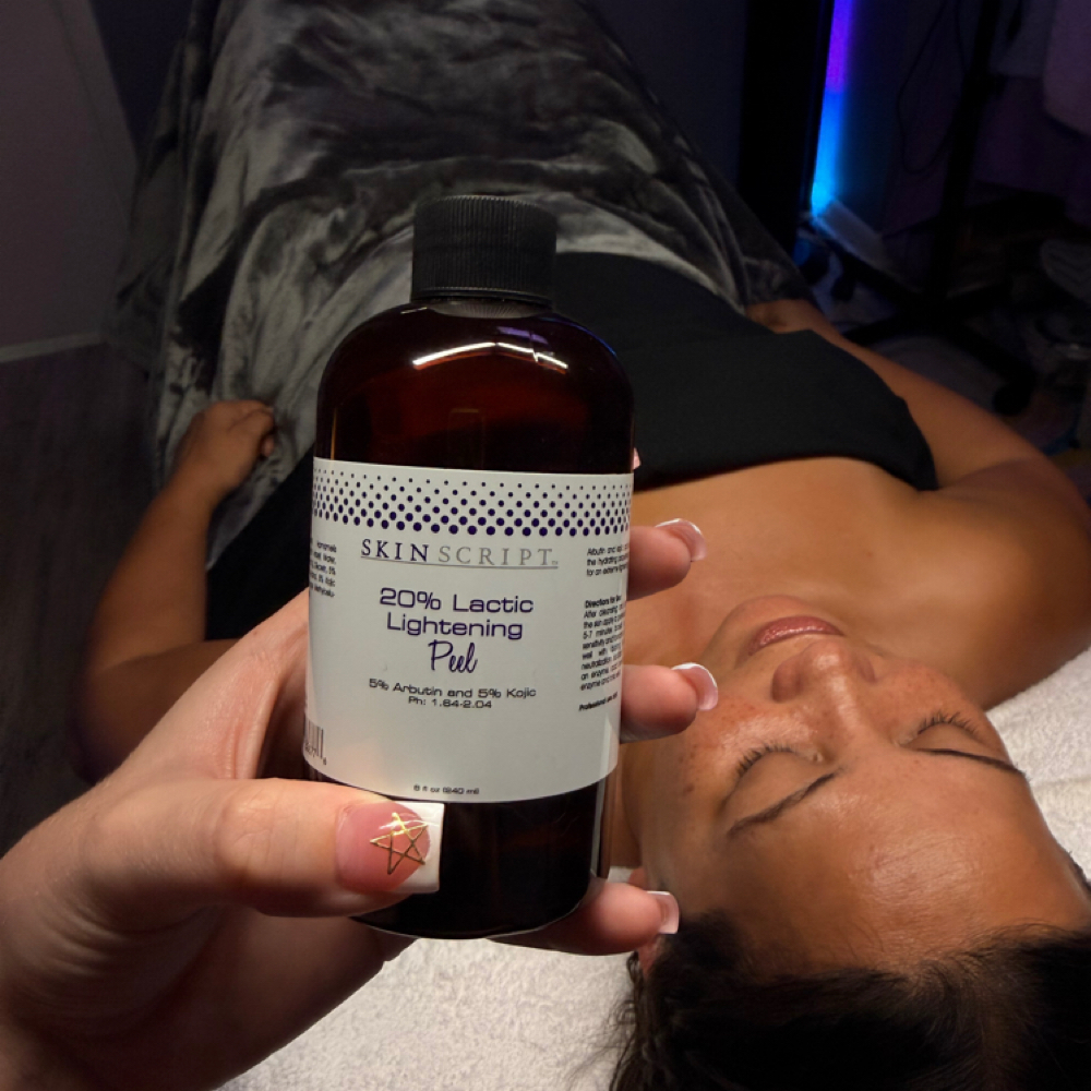 Chemical Peel Facial at Moonlight Aesthetics in pensacola, FL