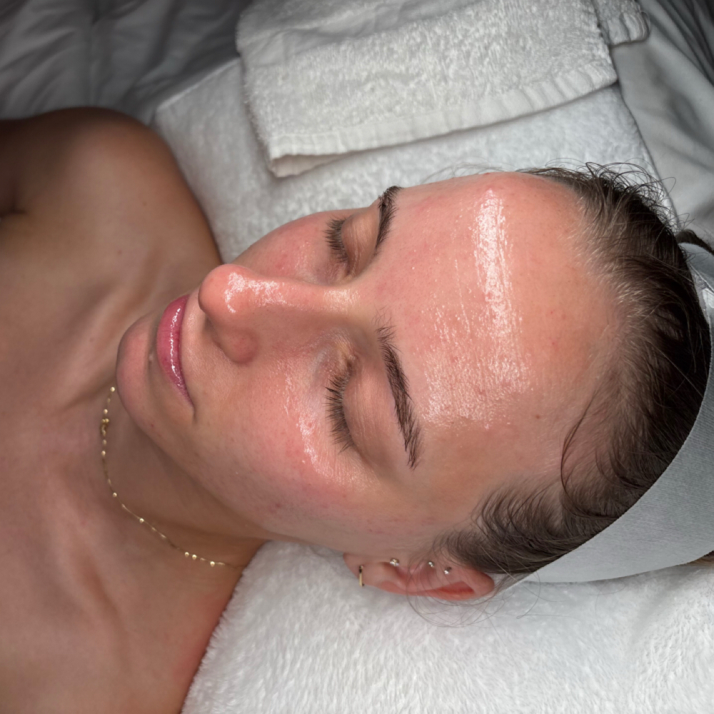 No Down Time Resurfacing Peel at Euphoria Skin in Chandler, AZ