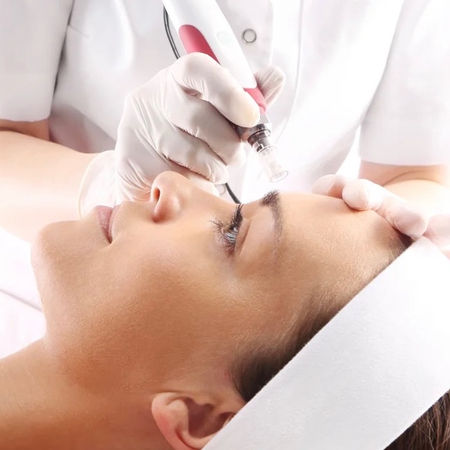 No-Needle Mesotherapy Treatment at Golden State Glam in Fair Oaks, CA