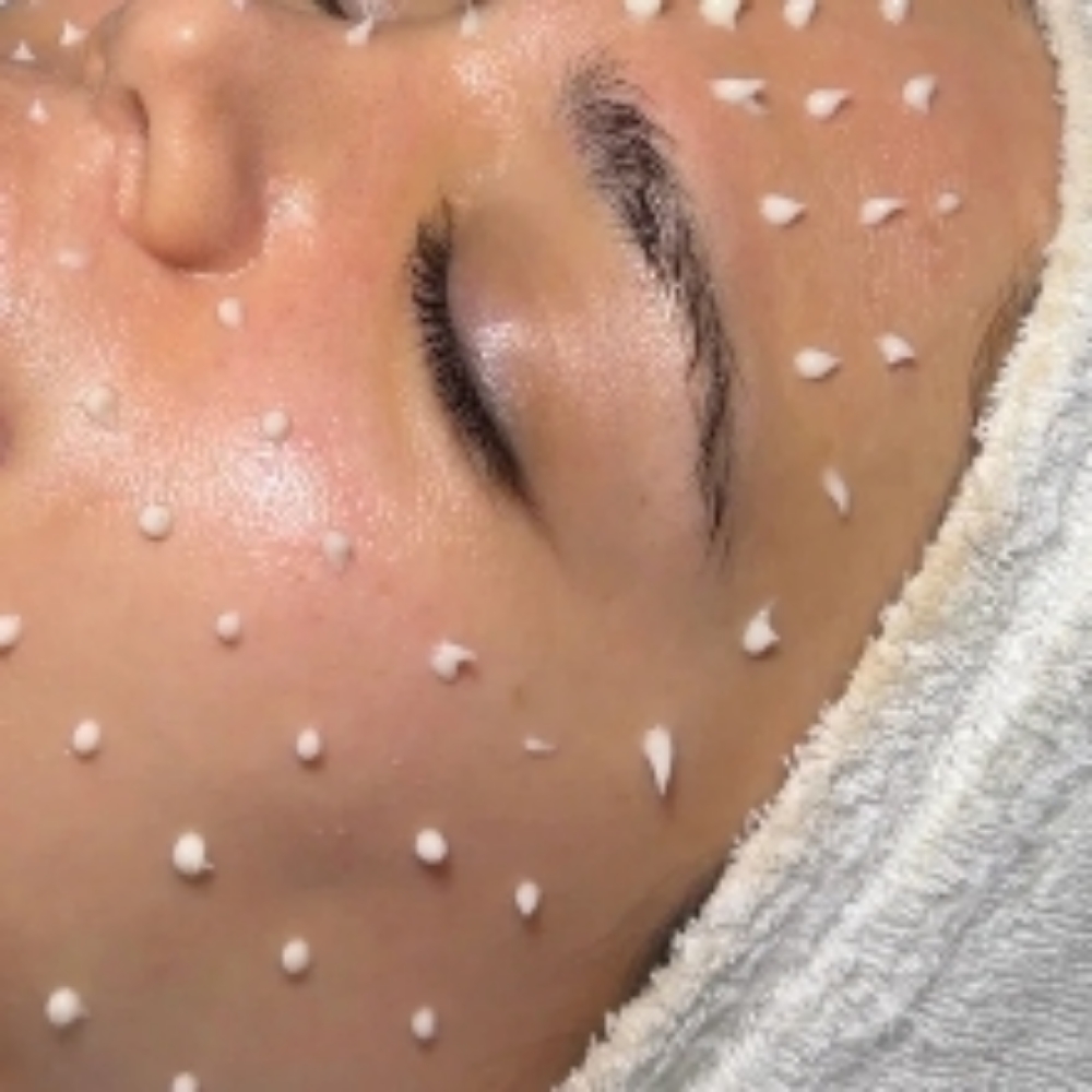 Liquid Microneedling at Flawless Glow in Delano, CA