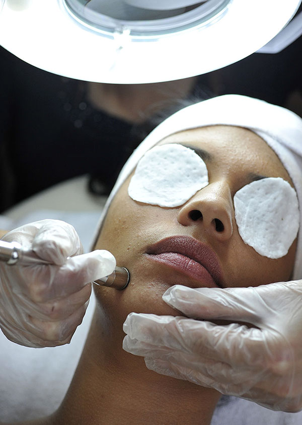 MicroDermbrasion Facial