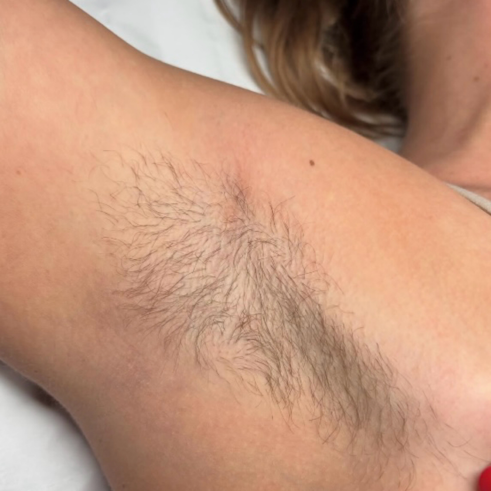 Underarm Waxing at The Bare Babe Studio OC in Fountain Valley, CA