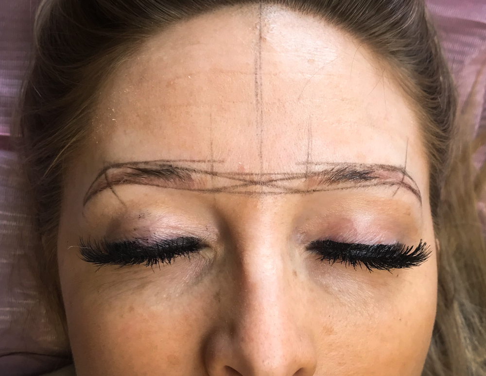 Brow Consultation