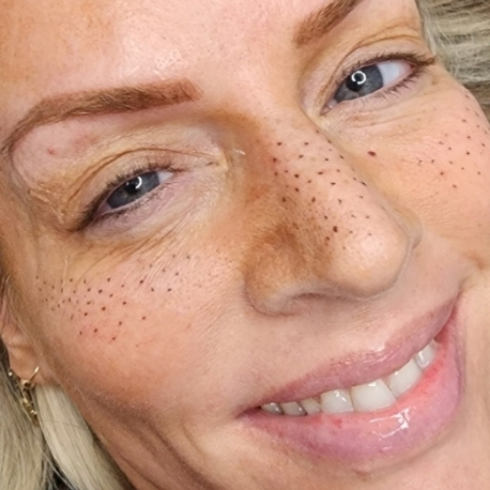 Semi-Permanent Freckles at Black Heart Ink and Aesthetics in Myrtle Beach, SC