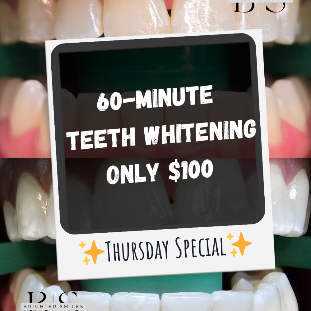 Thursdays 60 Minute Teeth Whitening