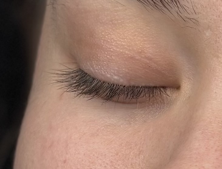 Lash Removal